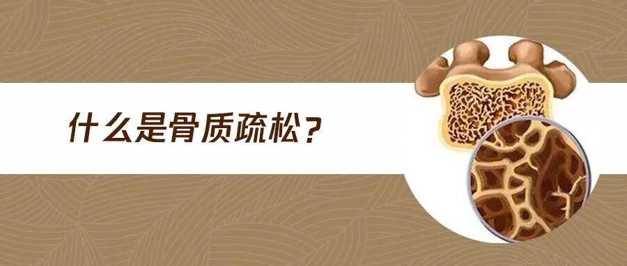 注意了！年轻人也可能会“骨脆脆”！