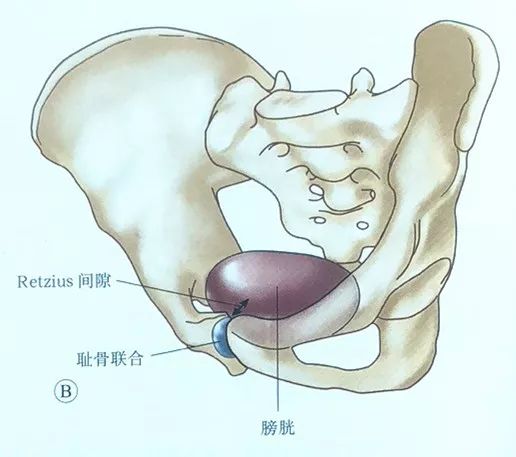 骨盆骨折的orif 骨视新野 微信公众号文章阅读 Wemp