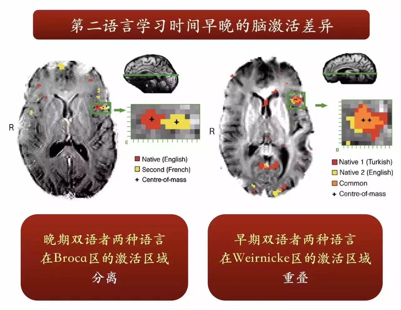 读音字是什么意思_一词中读是什么意思_axe是什么意思？怎么读