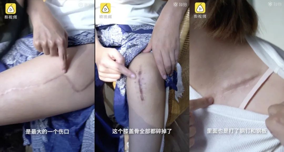 孕婦泰國墜崖451天後：「為了要我的命，他從相遇那天就計劃好了一切……」 情感 第21張