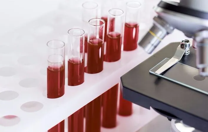 澳科学家—牛！莫纳什大学全球首家研发出COVID-19血液检测方法 20分钟可出结果 - 3