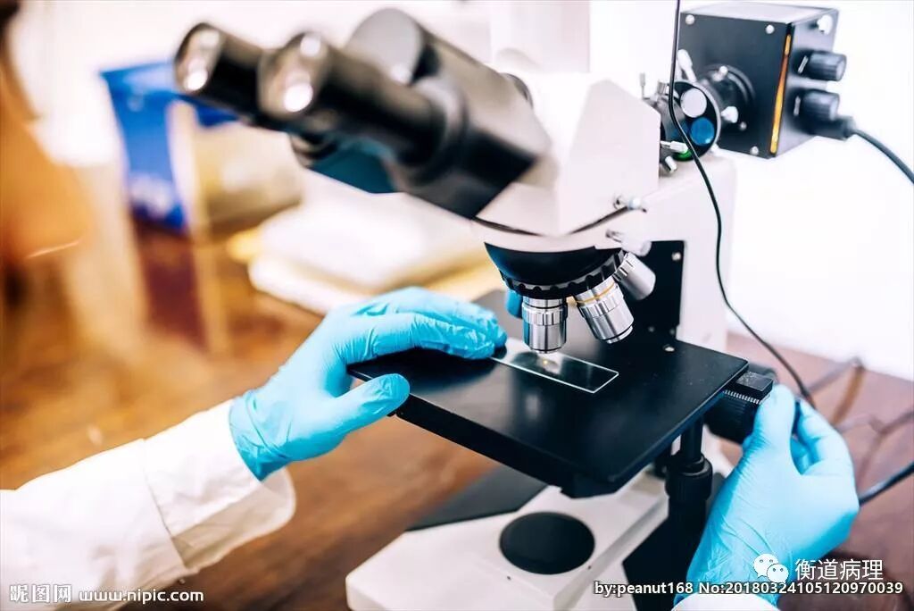 显微镜下的病理人生