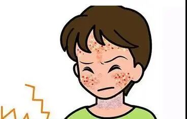 什么是窄谱紫外线治疗窄谱紫外线光疗仪让“牛皮癣”不再牛皮_https://www.jmylbn.com_新闻资讯_第7张