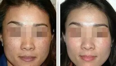 640?wx_fmt=jpeg&tp=webp&wxfrom=5&wx_lazy=1