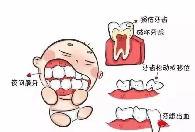 牙齿脱敏怎么收费【免费脱敏治疗】关于牙齿敏感，你都了解什么？_https://www.jmylbn.com_新闻资讯_第5张