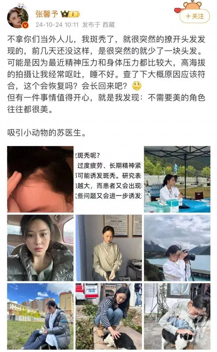 知名女演员自爆“斑秃”，身体与精神的双重压力是根源