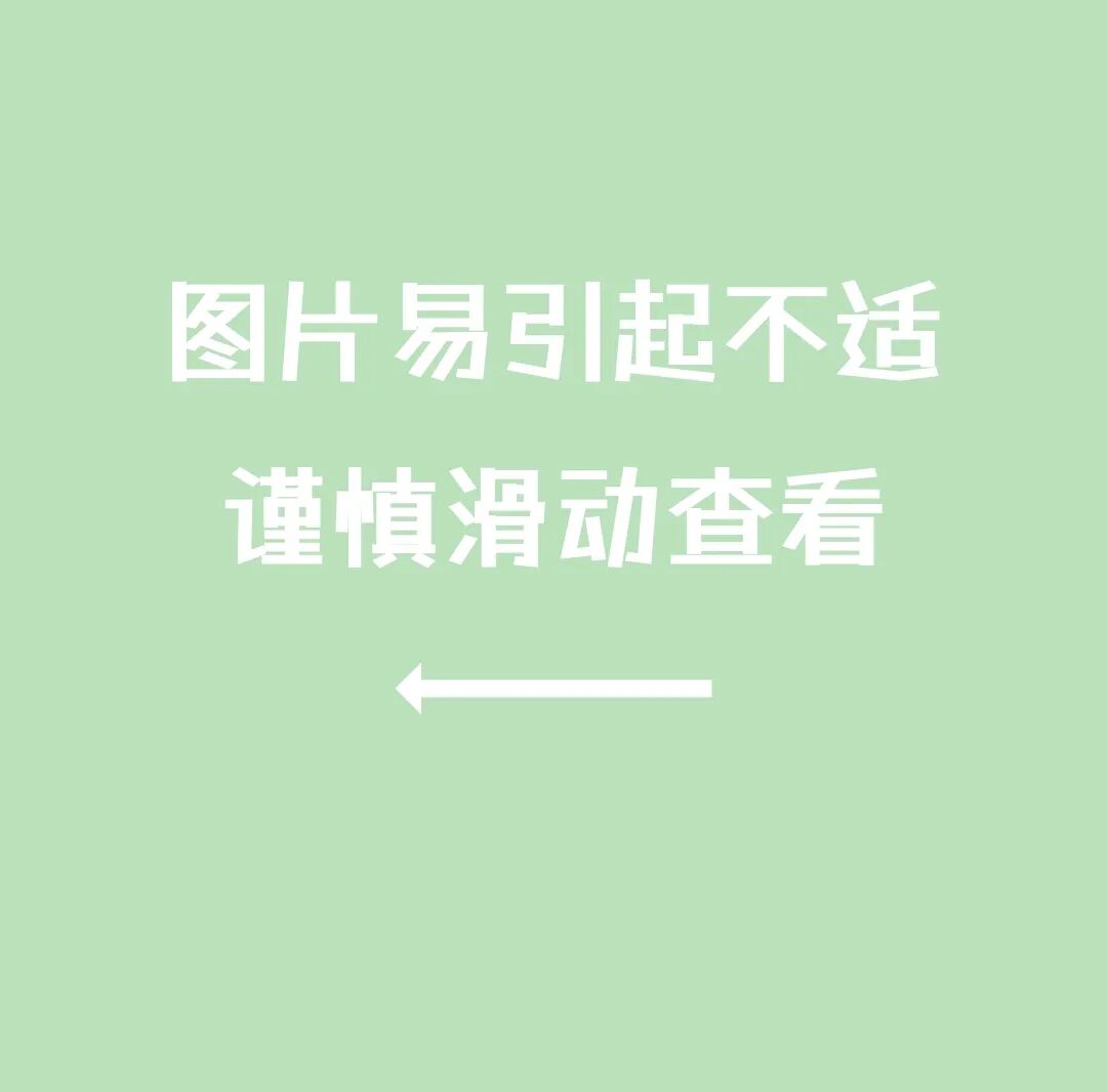 为什么负压引流让慢性伤口更快康复的好办法~_https://www.jmylbn.com_新闻资讯_第4张