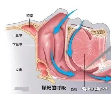 鼻甲肥大症状详解~