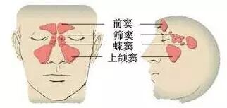 为什么会有鼻窦炎呢？
