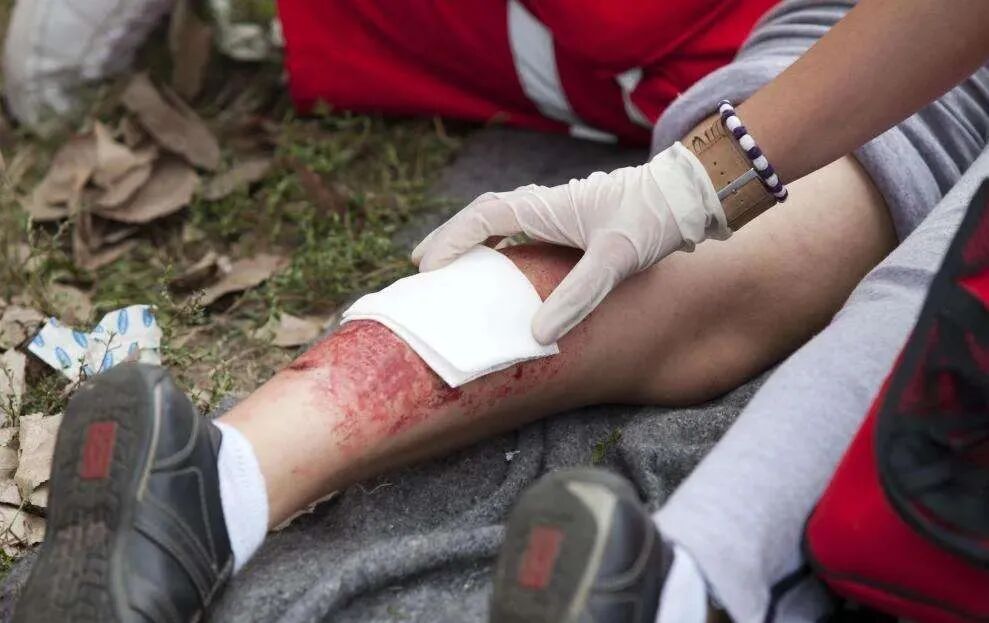 为什么纱布可以用来止血@家人看一看：人人都能学会的止血方法！_https://www.jmylbn.com_新闻资讯_第1张