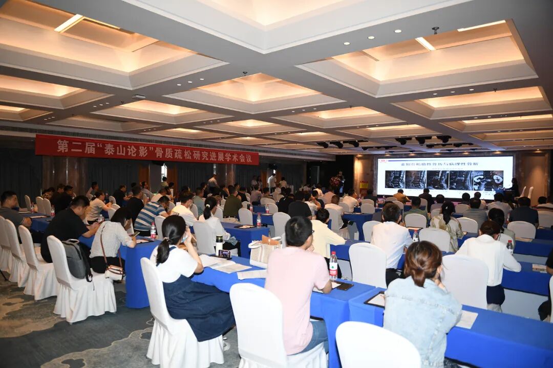 联影磁共振怎么样山一大二附院联影超高端3.0T磁共振uMR790、天河640CT开机仪式暨学术讲座成功举办_https://www.jmylbn.com_新闻资讯_第3张