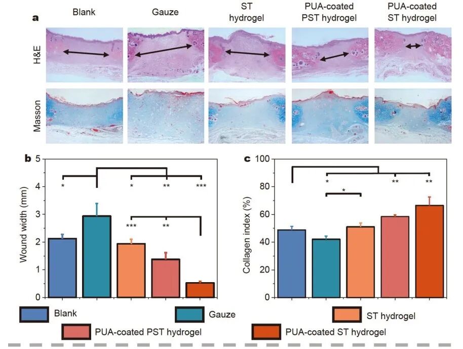 怎么撕敷料啊《Science China Materials》：用于伤口修复的无二次损伤的保水可撕断粘附水凝胶_https://www.jmylbn.com_新闻资讯_第9张