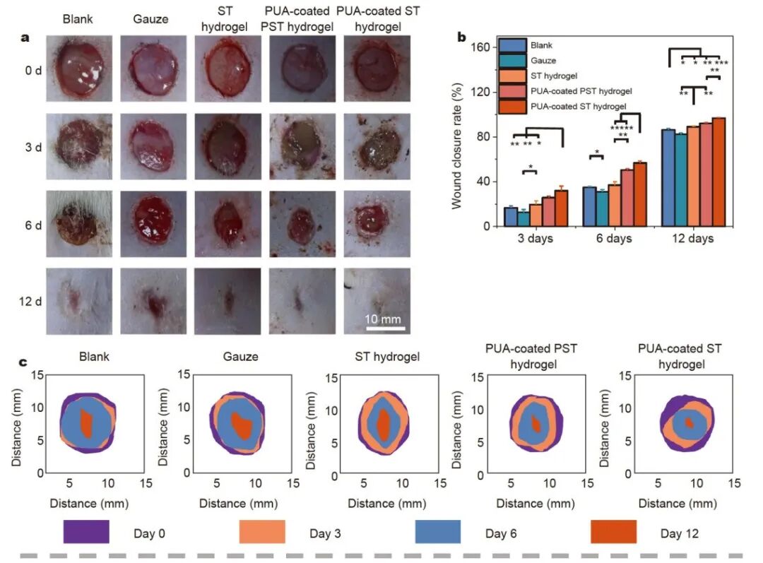 怎么撕敷料啊《Science China Materials》：用于伤口修复的无二次损伤的保水可撕断粘附水凝胶_https://www.jmylbn.com_新闻资讯_第8张