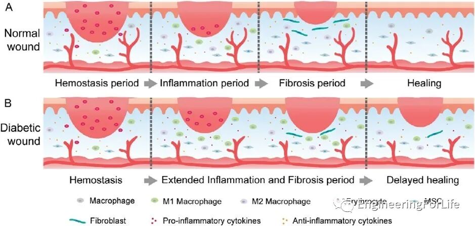 抗菌水凝胶怎么操作且看水凝胶如何“多点开花”整治糖尿病伤口_https://www.jmylbn.com_新闻资讯_第1张