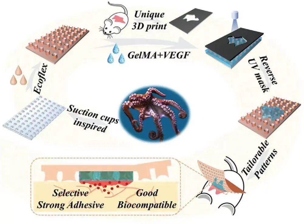 创面修复抗菌敷料怎么用创面修复中GelMA的应用_https://www.jmylbn.com_新闻资讯_第5张