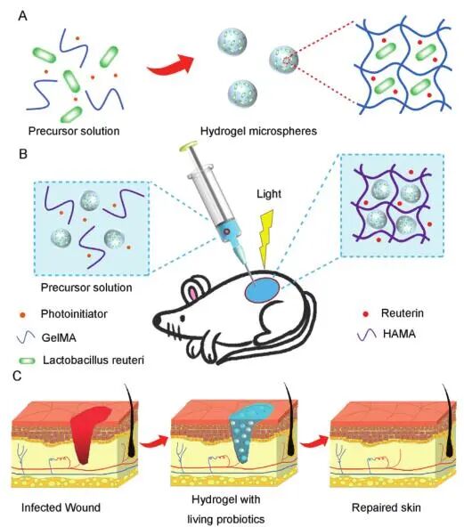 创面修复抗菌敷料怎么用创面修复中GelMA的应用_https://www.jmylbn.com_新闻资讯_第1张