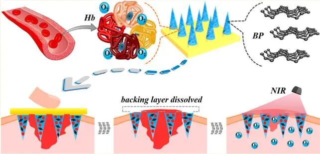 创面修复抗菌敷料怎么用创面修复中GelMA的应用_https://www.jmylbn.com_新闻资讯_第23张
