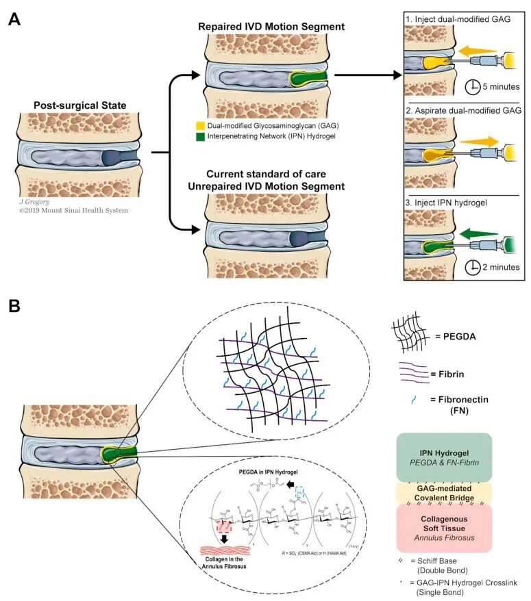 水凝胶伤口敷料怎么用【专题集锦】组织粘附与伤口敷料（20210803更新）_https://www.jmylbn.com_新闻资讯_第24张