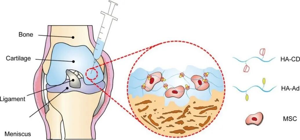 医用诱导骨基质是什么【专题集锦】软骨再生（20230111更新）_https://www.jmylbn.com_新闻资讯_第52张