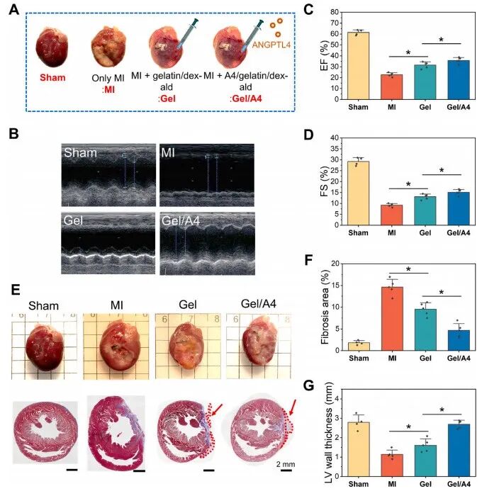 明胶在血管怎么降解《Bioactive Materials》：持续缓释抗炎蛋白的可涂黏附性水凝胶心脏贴片！用于心肌梗死的修复_https://www.jmylbn.com_新闻资讯_第8张