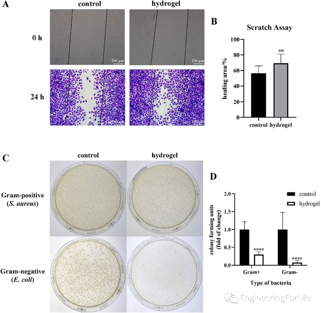壳聚糖治什么病《Carbohydr. Polym.》：可注射自愈合的壳聚糖杂化水凝胶敷料促进糖尿病伤口愈合_https://www.jmylbn.com_新闻资讯_第6张