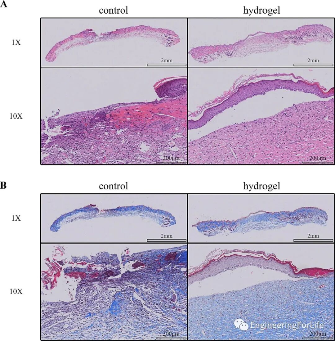 壳聚糖治什么病《Carbohydr. Polym.》：可注射自愈合的壳聚糖杂化水凝胶敷料促进糖尿病伤口愈合_https://www.jmylbn.com_新闻资讯_第8张