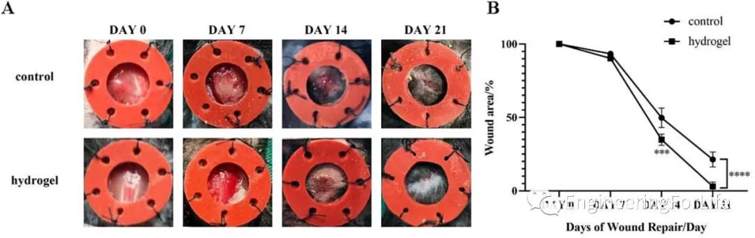 壳聚糖治什么病《Carbohydr. Polym.》：可注射自愈合的壳聚糖杂化水凝胶敷料促进糖尿病伤口愈合_https://www.jmylbn.com_新闻资讯_第7张