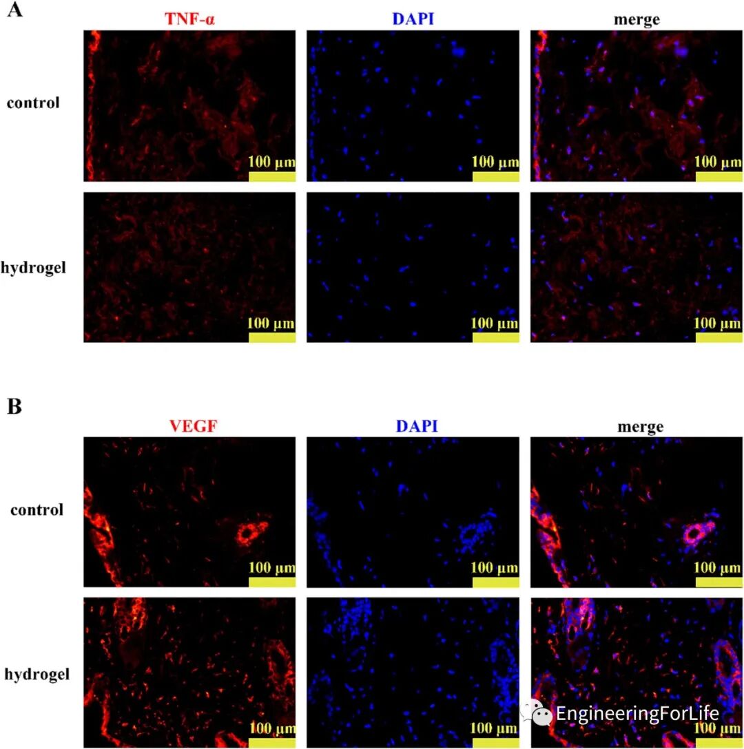 壳聚糖治什么病《Carbohydr. Polym.》：可注射自愈合的壳聚糖杂化水凝胶敷料促进糖尿病伤口愈合_https://www.jmylbn.com_新闻资讯_第9张