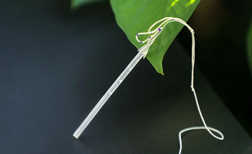 患者怎么选择人工鼻鼻泪管阻塞患者应用人工鼻泪管支架逆行置入手术的安全性及有效性分析_https://www.jmylbn.com_新闻资讯_第1张