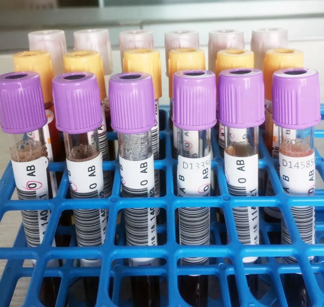 血袋号是什么血袋上的条形码有什么作用？_https://www.jmylbn.com_新闻资讯_第7张