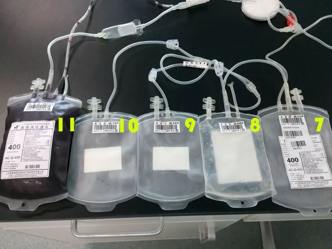血袋号是什么血袋上的条形码有什么作用？_https://www.jmylbn.com_新闻资讯_第8张