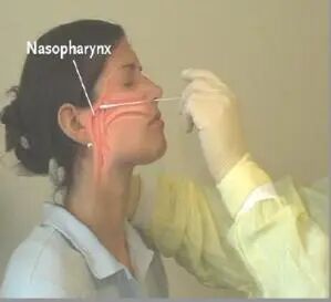 流感病毒怎么采样吴文娟主任：发热门诊呼吸道病原体快速筛查丨解密流感（3）_https://www.jmylbn.com_新闻资讯_第8张