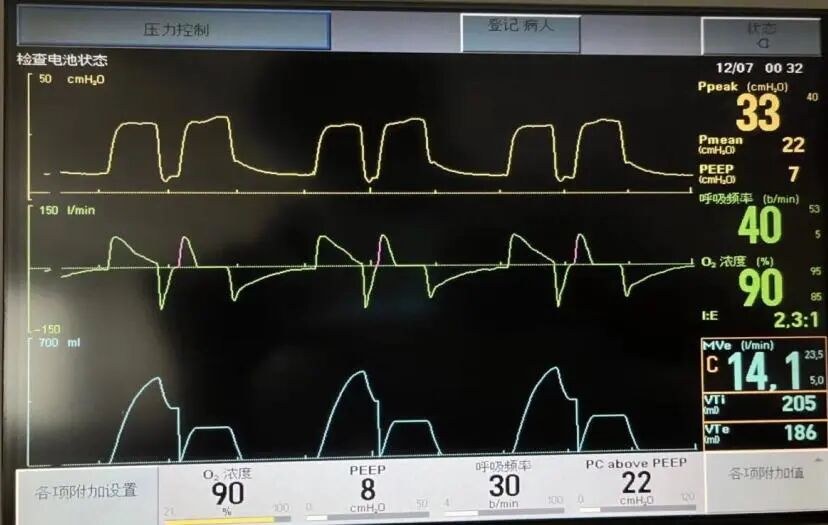 为什么呼吸机人机同步基层医院如何识别与处理「人机不同步」？为何说要防止为追求波形完美而调节呼吸机参数？_https://www.jmylbn.com_新闻资讯_第3张