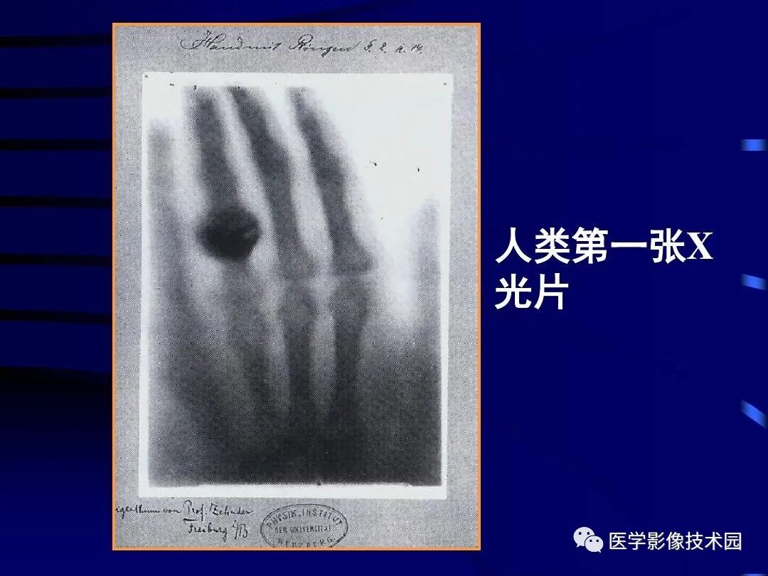 x线为什么锥形束影像学之X线检查--X线发现、X线产生、X线成像、X线特性_https://www.jmylbn.com_新闻资讯_第1张