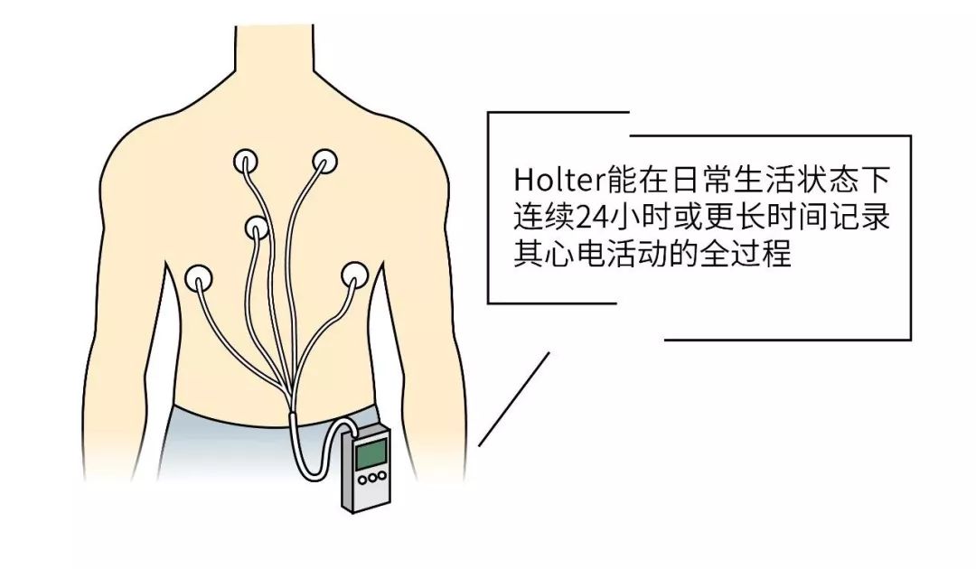 心脏不难受,为什么还要去查心电图?