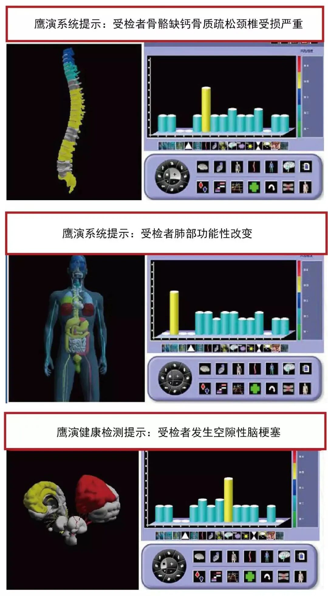 法国鹰演怎么查199元体验法国鹰演全身健康扫描！每天限量抢_https://www.jmylbn.com_新闻资讯_第7张
