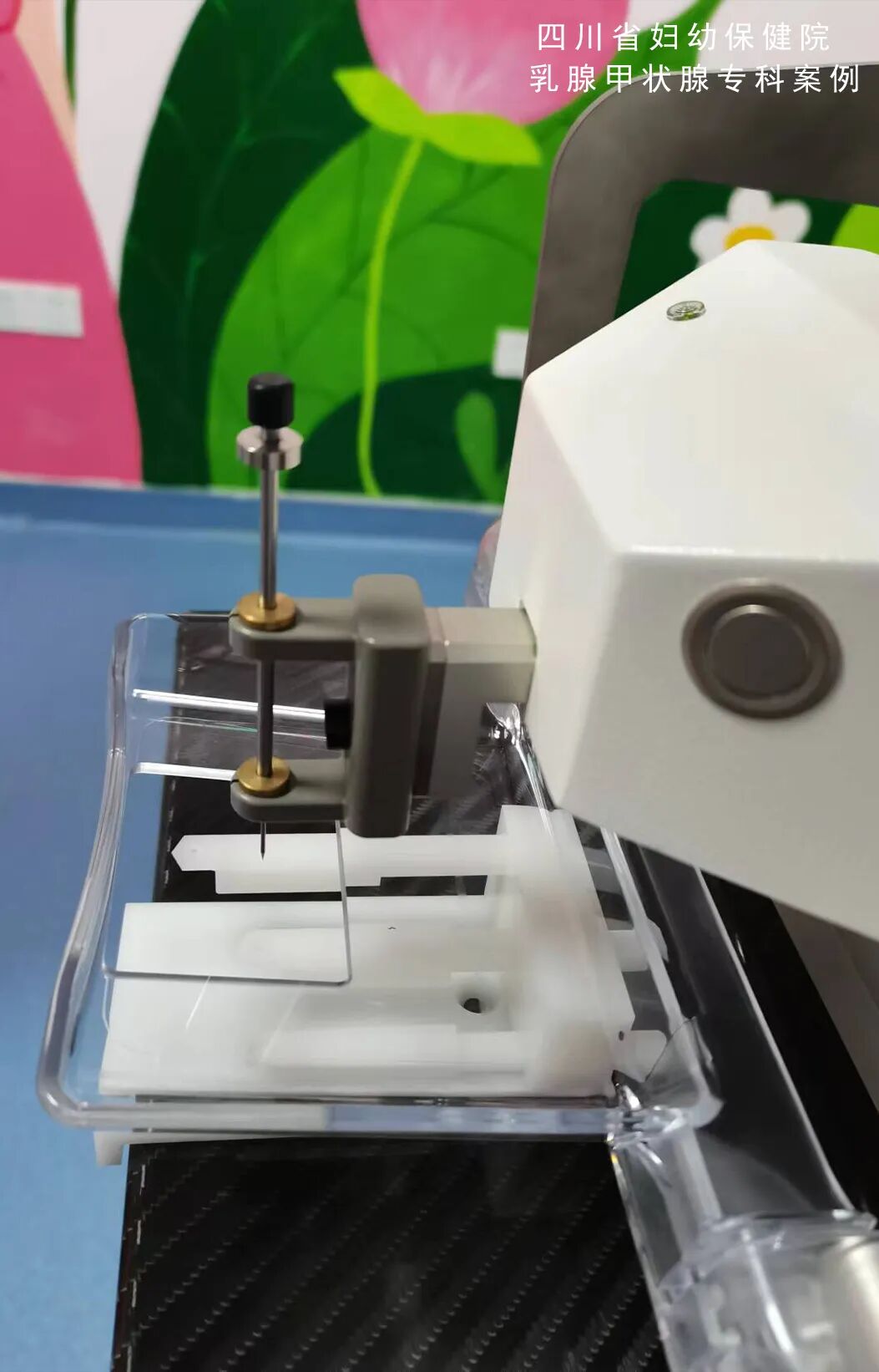 怎么制造手术钩针看医生如何精准“钩出”乳腺钙化灶，将早期乳腺癌“绳之以法”_https://www.jmylbn.com_新闻资讯_第6张