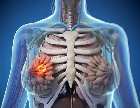 乳房肿块、乳腺囊肿、乳腺增生，三七粉+它是最佳选择！