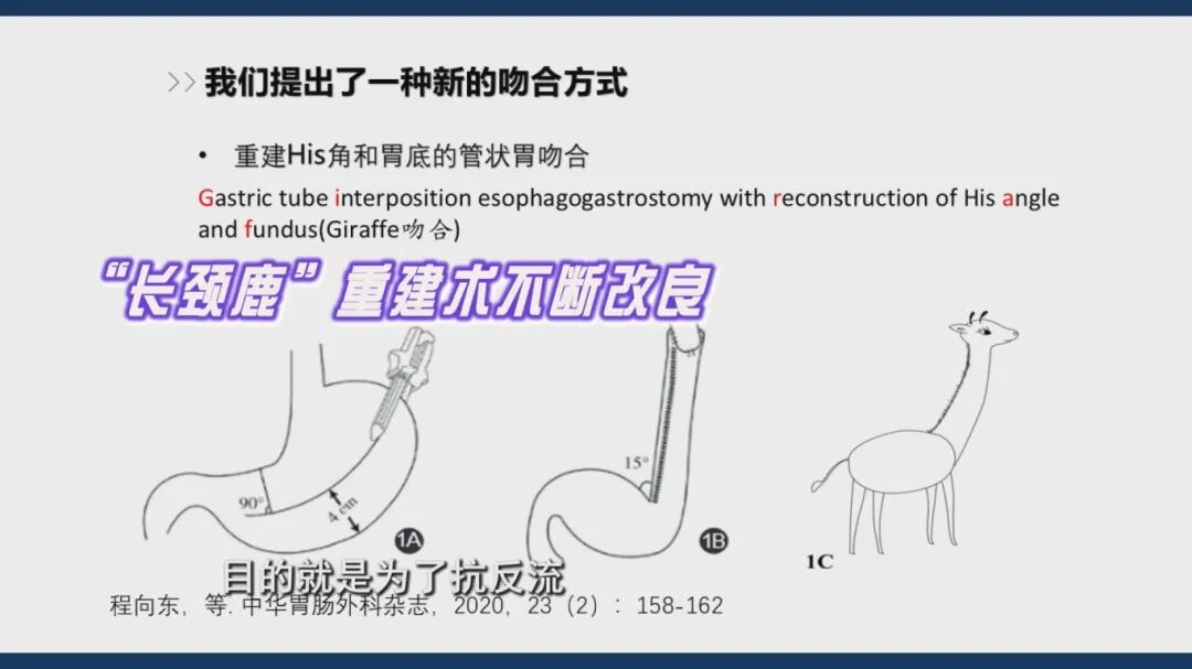 1.22《养生大国医》“保胃”手术有哪三种术式？什么是胃癌保功能“长颈鹿”手术？和传统全切术相比，它有什么优势？[00-06-24][20260122-171621319].jpg