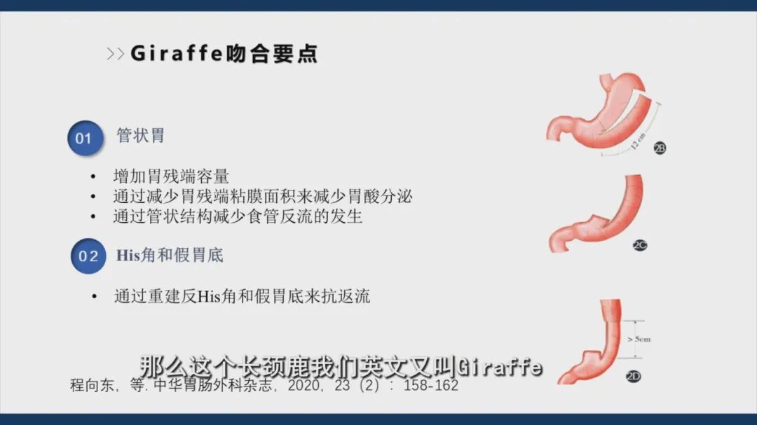 1.22《养生大国医》“保胃”手术有哪三种术式？什么是胃癌保功能“长颈鹿”手术？和传统全切术相比，它有什么优势？[00-03-44][20260122-171501102].jpg