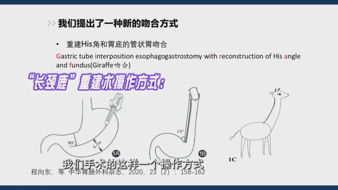 1.22《养生大国医》“保胃”手术有哪三种术式？什么是胃癌保功能“长颈鹿”手术？和传统全切术相比，它有什么优势？[00-05-05][20260122-171542570].jpg