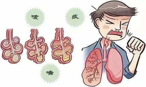 一文看懂老慢支肺气肿及慢阻肺的区别识别症状相似却易混淆的呼吸系统