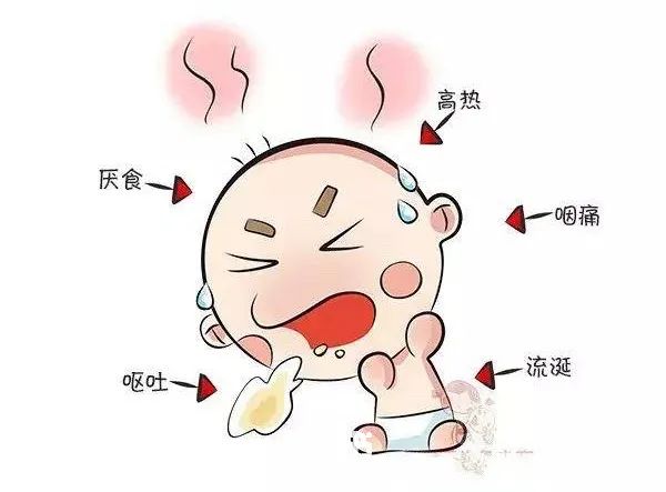 小儿发烧嗓子疼有白点警惕疱疹性咽峡炎防治应该这么做