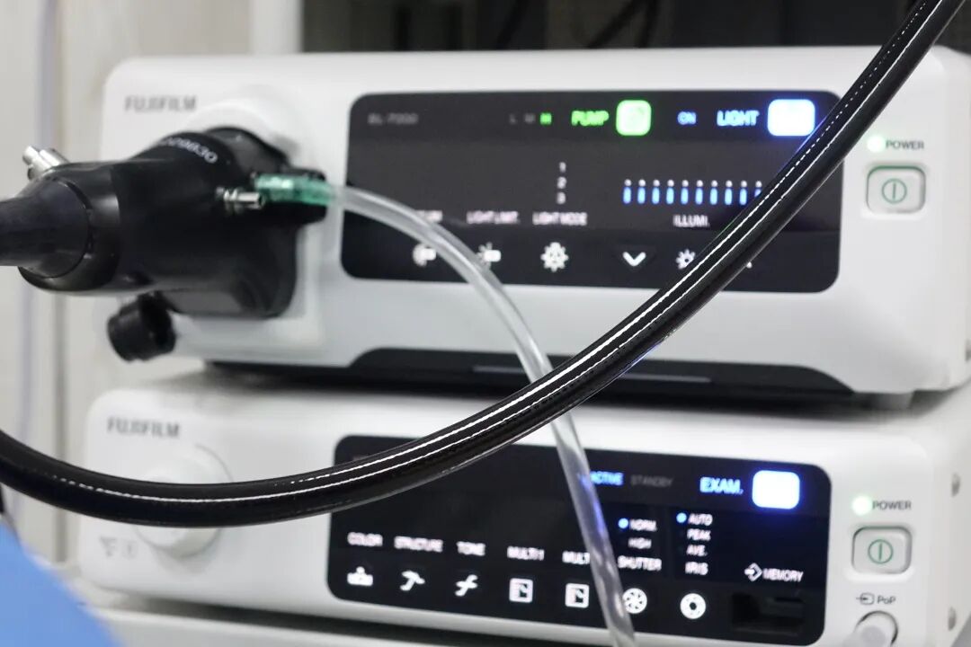 电子胃镜镜是什么一文读懂！“消化道保护神”——电子胃肠镜检查流程_https://www.jmylbn.com_新闻资讯_第7张