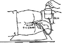 结肠水疗仪怎么操作【重塑肠道健康】肠道水疗 祝您肠“轻”——给您的肠道做个SPA_https://www.jmylbn.com_新闻资讯_第11张