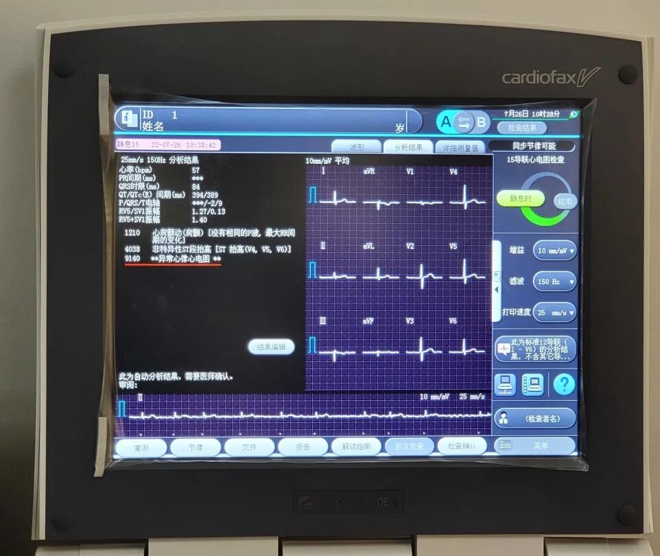 日本心电图怎么用营口市中西医结合医院最新引进日本光电次世代高端心电图机ECG-2450_https://www.jmylbn.com_新闻资讯_第17张