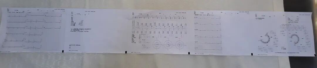 日本心电图怎么用营口市中西医结合医院最新引进日本光电次世代高端心电图机ECG-2450_https://www.jmylbn.com_新闻资讯_第5张