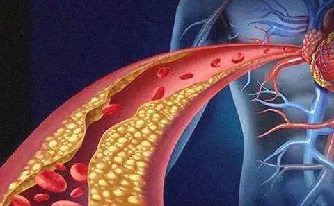益康治疗仪怎么样美益康＂洫通＂半导体激光治疗仪的作用机理_https://www.jmylbn.com_新闻资讯_第2张