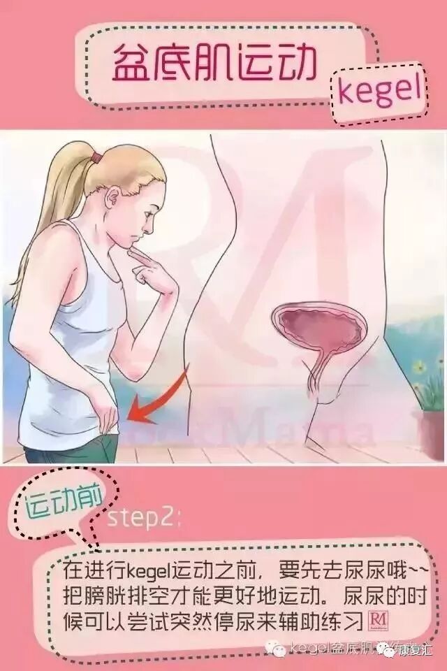 产后怎么康复治疗产后盆底肌肉的功能评估与康复治疗方案_https://www.jmylbn.com_新闻资讯_第5张