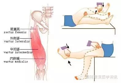 怎么评估病人肌力运动功能检查｜肌力评估_https://www.jmylbn.com_新闻资讯_第25张